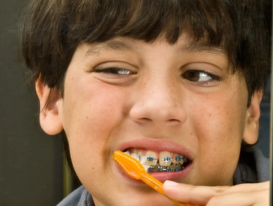 Jak motywować dziecko do dbania o higienę z aparatem ortodontycznym?