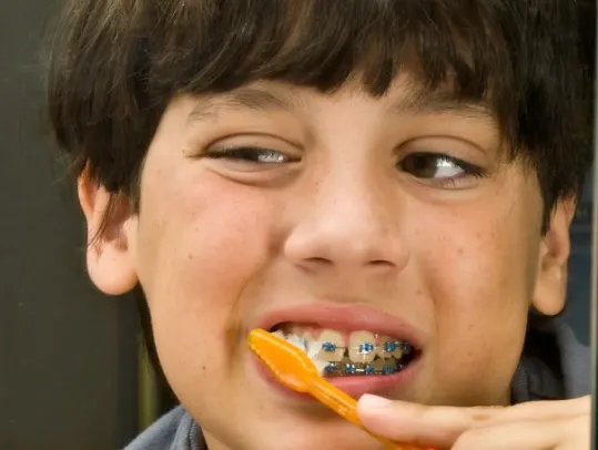 Jak motywować dziecko do dbania o higienę z aparatem ortodontycznym?